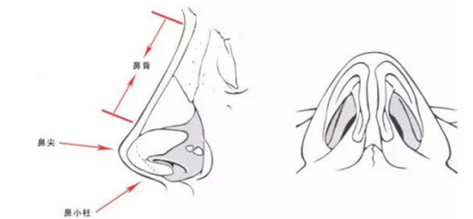 成都做膨体隆鼻子有副作用吗