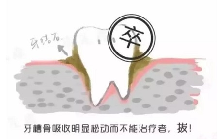 牙齿矫正可以用一辈子吗？