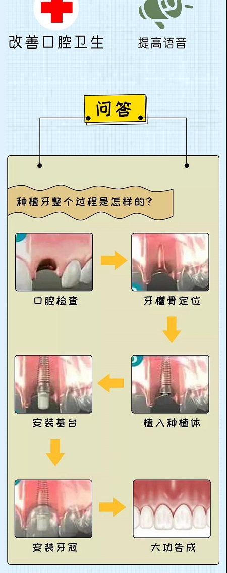 牙齿矫正可以用一辈子吗？